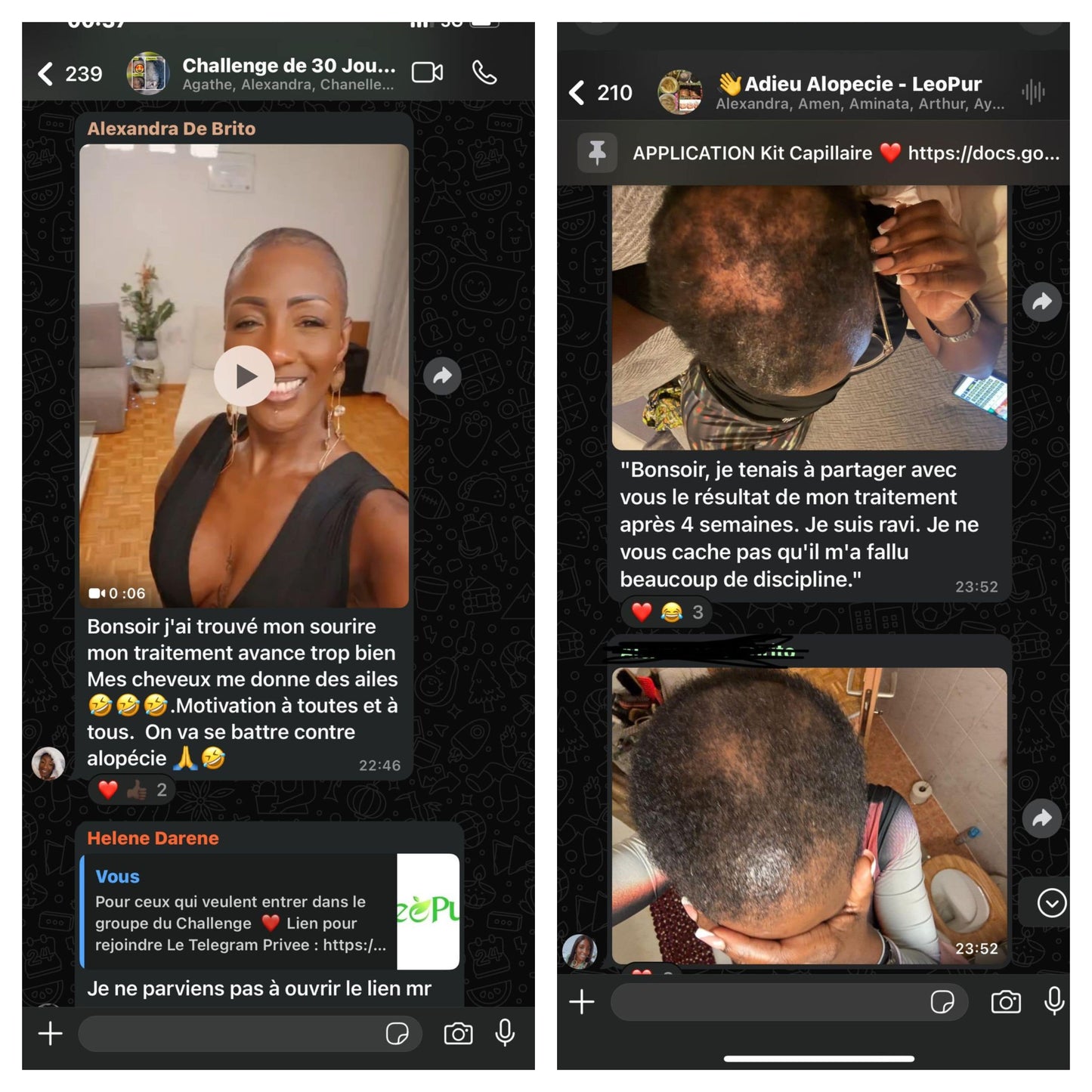 Kit Alopecie