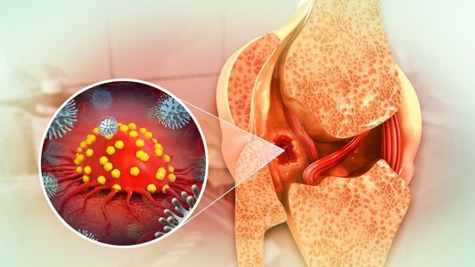 Vaincre le cancer des os grâce Témoignage de Hugo 🙏